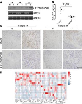 Suppression of Esophageal Cancer Stem-like Cells by SNX-2112 Is Enhanced by STAT3 Silencing